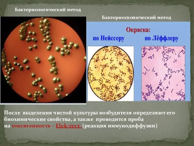 Бактериологический метод Бактериоскопический метод После выделения чистой культуры возбудителя определяют его биохимические