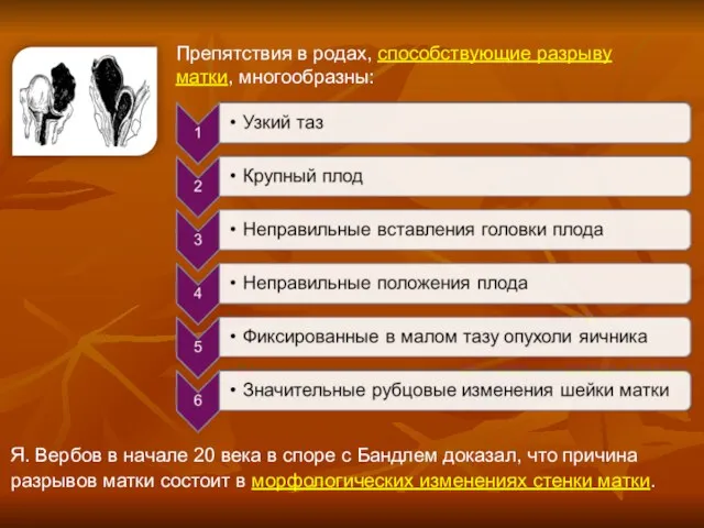 Препятствия в родах, способствующие разрыву матки, многообразны: Я. Вербов в начале 20