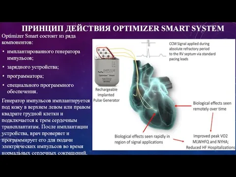 ПРИНЦИП ДЕЙСТВИЯ OPTIMIZER SMART SYSTEM Optimizer Smart состоит из ряда компонентов: имплантированного
