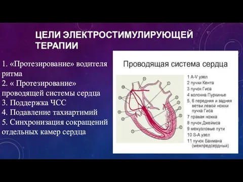 ЦЕЛИ ЭЛЕКТРОСТИМУЛИРУЮЩЕЙ ТЕРАПИИ 1. «Протезирование» водителя ритма 2. « Протезирование» проводящей системы