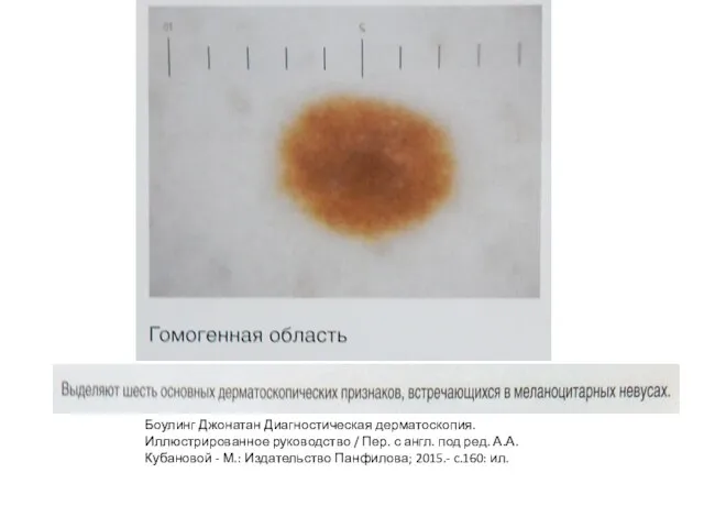 Боулинг Джонатан Диагностическая дерматоскопия. Иллюстрированное руководство / Пер. с англ. под ред.