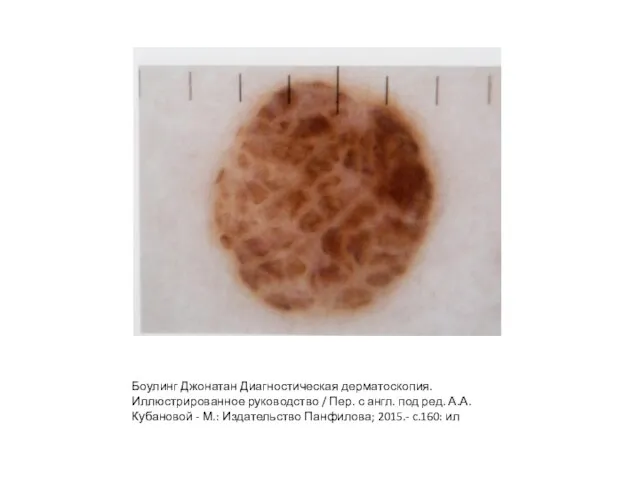 Боулинг Джонатан Диагностическая дерматоскопия. Иллюстрированное руководство / Пер. с англ. под ред.