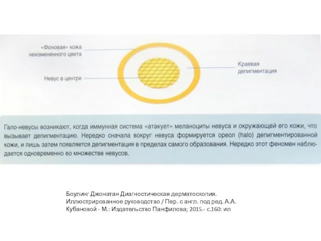 Боулинг Джонатан Диагностическая дерматоскопия. Иллюстрированное руководство / Пер. с англ. под ред.