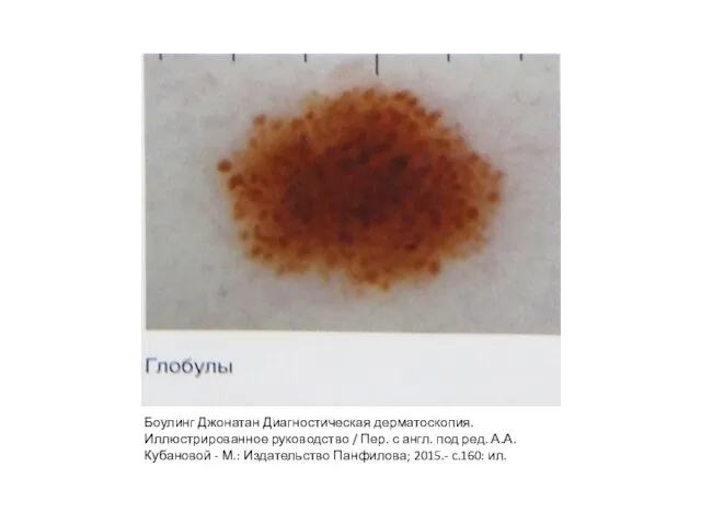 Боулинг Джонатан Диагностическая дерматоскопия. Иллюстрированное руководство / Пер. с англ. под ред.