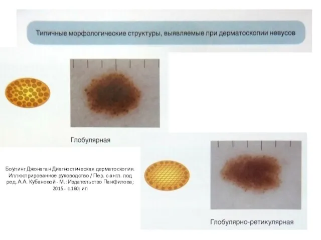 Боулинг Джонатан Диагностическая дерматоскопия. Иллюстрированное руководство / Пер. с англ. под ред.
