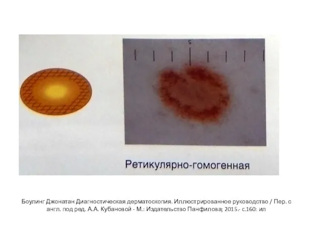Боулинг Джонатан Диагностическая дерматоскопия. Иллюстрированное руководство / Пер. с англ. под ред.