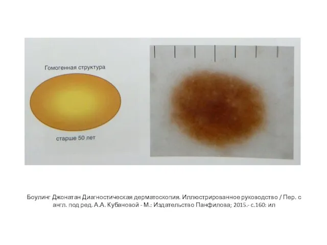 Боулинг Джонатан Диагностическая дерматоскопия. Иллюстрированное руководство / Пер. с англ. под ред.