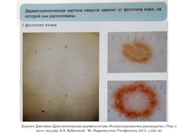 Боулинг Джонатан Диагностическая дерматоскопия. Иллюстрированное руководство / Пер. с англ. под ред.