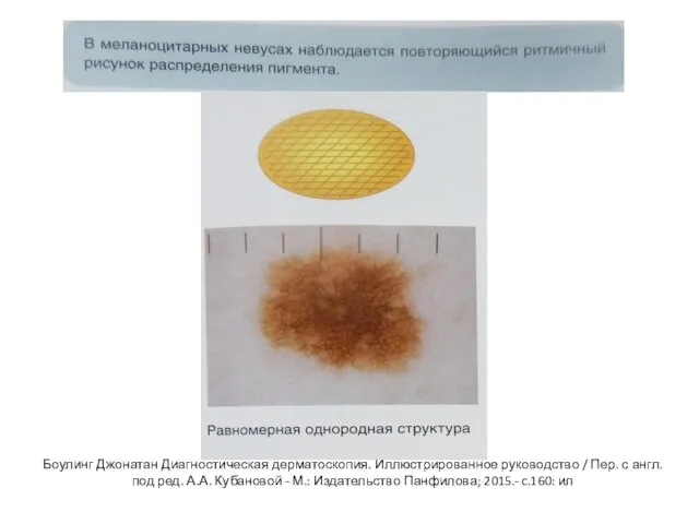Боулинг Джонатан Диагностическая дерматоскопия. Иллюстрированное руководство / Пер. с англ. под ред.