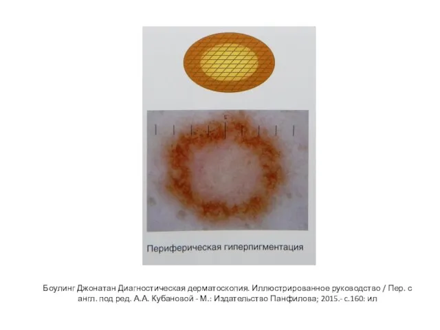 Боулинг Джонатан Диагностическая дерматоскопия. Иллюстрированное руководство / Пер. с англ. под ред.