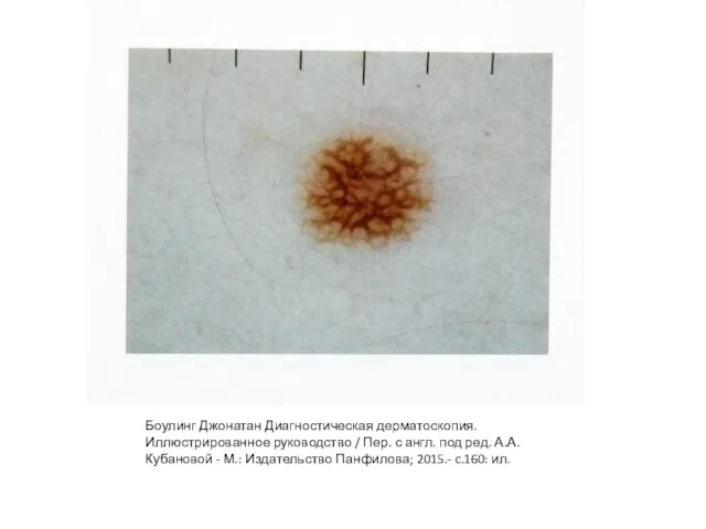 Боулинг Джонатан Диагностическая дерматоскопия. Иллюстрированное руководство / Пер. с англ. под ред.