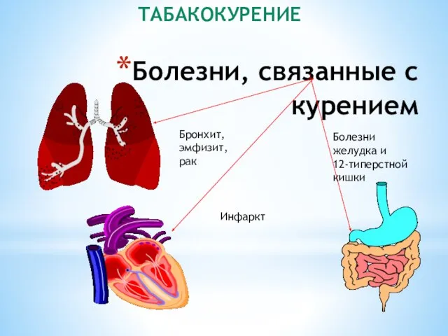 Болезни, связанные с курением Бронхит, эмфизит, рак Инфаркт Болезни желудка и 12-типерстной кишки ТАБАКОКУРЕНИЕ