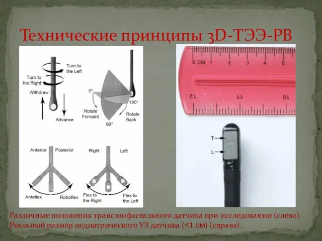 Технические принципы 3D-ТЭЭ-РВ Различные положения трансэзофагеального датчика при исследовании (слева). Реальный размер