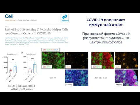 COVID-19 подавляет иммунный ответ При тяжелой форме COVID-19 разрушаются герминальные центры лимфоузлов