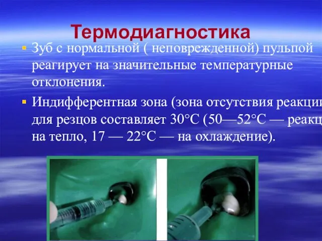 Термодиагностика Зуб с нормальной ( неповрежденной) пульпой реагирует на значительные температурные отклонения.