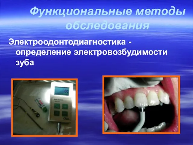 Функциональные методы обследования Электроодонтодиагностика - определение электровозбудимости зуба