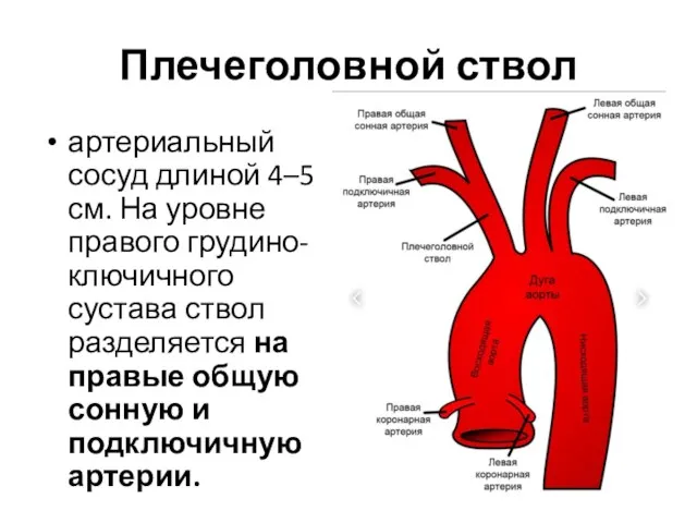 Плечеголовной ствол артериальный сосуд длиной 4–5 см. На уровне правого грудино-ключичного сустава