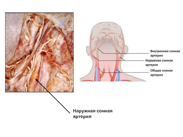 Наружная сонная артерия