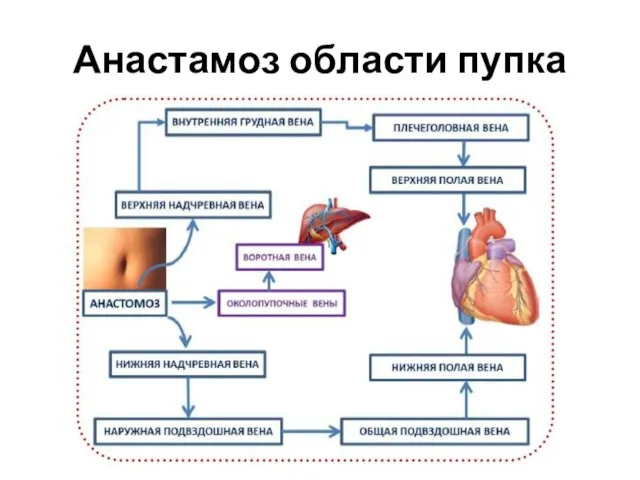 Анастамоз области пупка