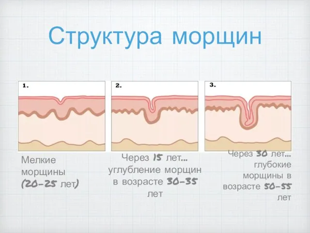 Структура морщин Мелкие морщины (20-25 лет) Через 15 лет... углубление морщин в