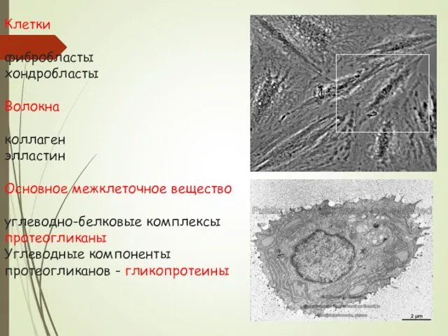 Клетки фибробласты хондробласты Волокна коллаген элластин Основное межклеточное вещество углеводно-белковые комплексы протеогликаны