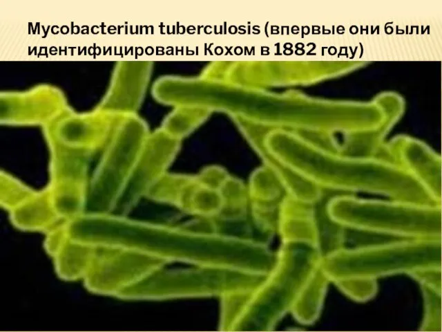 Мусоbacterium tuberculosis (впервые они были идентифицированы Кохом в 1882 году)