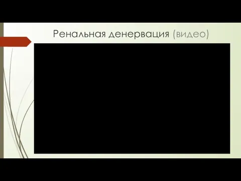 Ренальная денервация (видео)