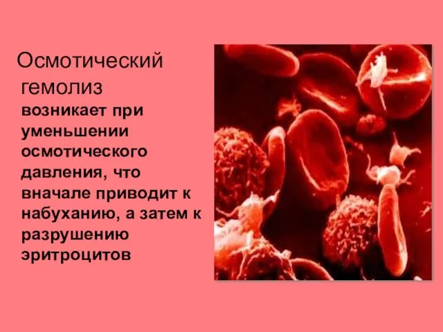 Осмотический гемолиз возникает при уменьшении осмотического давления, что вначале приводит к набуханию,