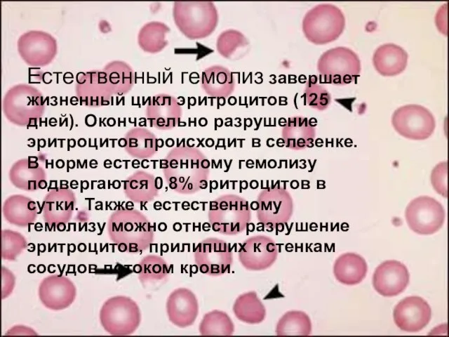 Естественный гемолиз завершает жизненный цикл эритроцитов (125 дней). Окончательно разрушение эритроцитов происходит