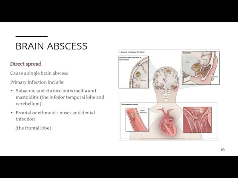 BRAIN ABSCESS Direct spread Cause a single brain abscess Primary infection include: