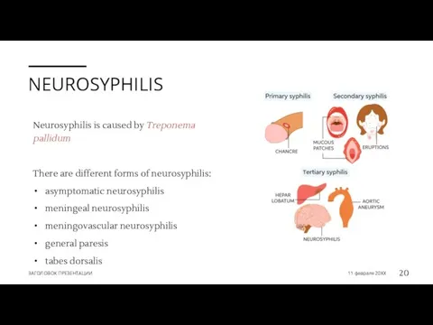 NEUROSYPHILIS Neurosyphilis is caused by Treponema pallidum There are different forms of