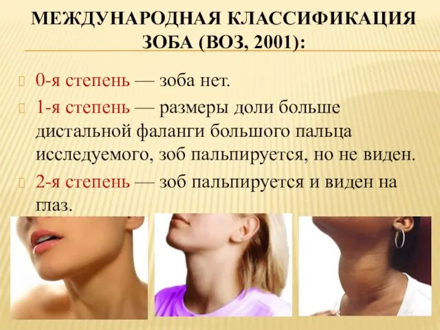 МЕЖДУНАРОДНАЯ КЛАССИФИКАЦИЯ ЗОБА (ВОЗ, 2001): 0-я степень — зоба нет. 1-я степень