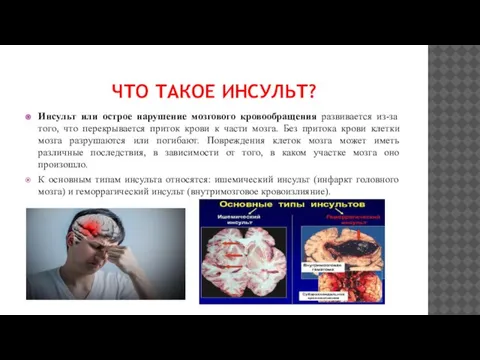 ЧТО ТАКОЕ ИНСУЛЬТ? Инсульт или острое нарушение мозгового кровообращения развивается из-за того,