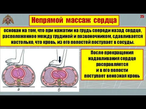 25 основан на том, что при нажатии на грудь спереди назад сердце,