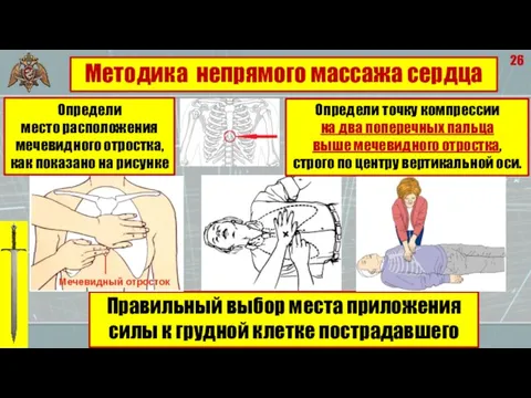 26 Правильный выбор места приложения силы к грудной клетке пострадавшего Методика непрямого