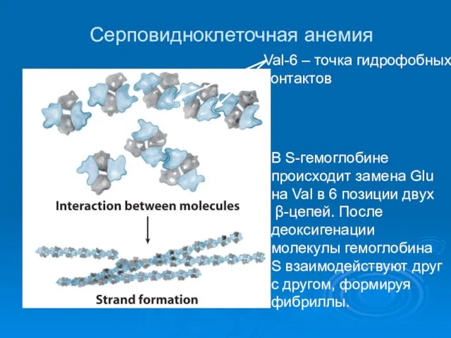 Cерповидноклеточная анемия В S-гемоглобине происходит замена Glu на Val в 6 позиции