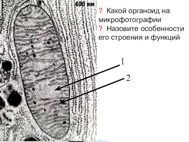 ? Какой органоид на микрофотографии ? Назовите особенности его строения и функций 1 2