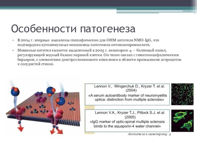 Особенности патогенеза В 2004 г. впервые выявлены специфические для ОНМ антитела NMO-IgG,