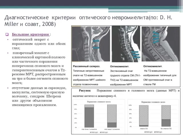 Диагностические критерии оптического невромиелита(по: D. H. Miller и соавт, 2008) Большие критерии