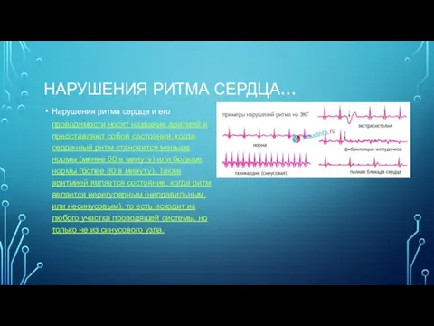 НАРУШЕНИЯ РИТМА СЕРДЦА… Нарушения ритма сердца и его проводимости носят название аритмий