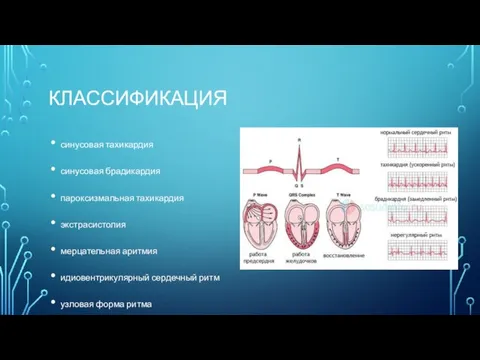 КЛАССИФИКАЦИЯ синусовая тахикардия синусовая брадикардия пароксизмальная тахикардия экстрасистолия мерцательная аритмия идиовентрикулярный сердечный ритм узловая форма ритма