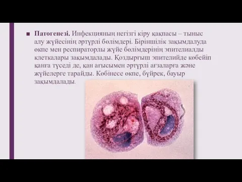 Патогенезі. Инфекцияның негізгі кіру қақпасы – тыныс алу жүйесінің әртүрлі бөлімдері. Біріншілік