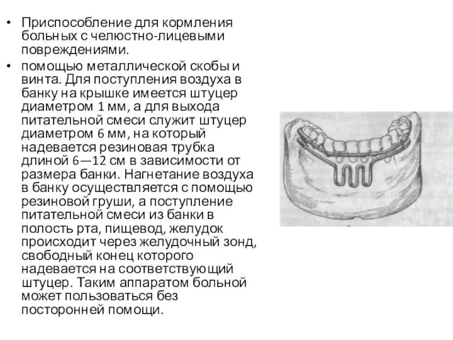 Приспособление для кормления больных с челюстно-лицевыми повреждениями. помощью металлической скобы и винта.