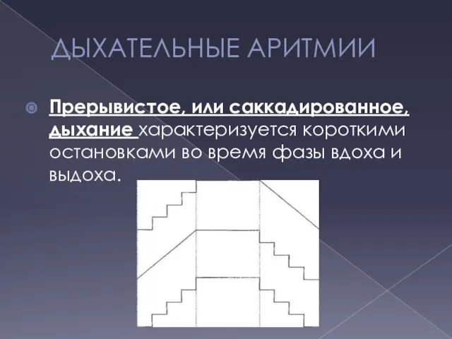 ДЫХАТЕЛЬНЫЕ АРИТМИИ Прерывистое, или саккадированное, дыхание характеризуется короткими остановками во время фазы вдоха и выдоха.