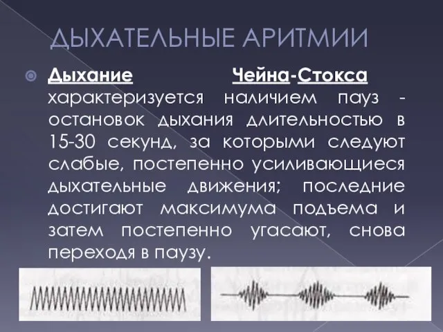 ДЫХАТЕЛЬНЫЕ АРИТМИИ Дыхание Чейна-Стокса характеризуется наличием пауз - остановок дыхания длительностью в