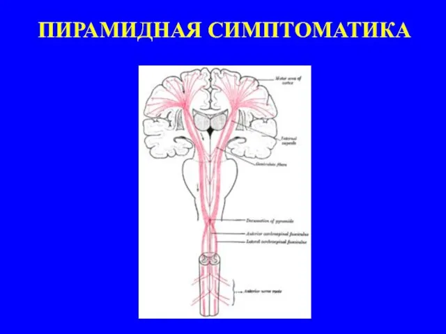 ПИРАМИДНАЯ СИМПТОМАТИКА