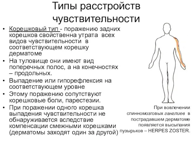 Типы расстройств чувствительности Корешковый тип - поражению задних корешков свойственна утрата всех