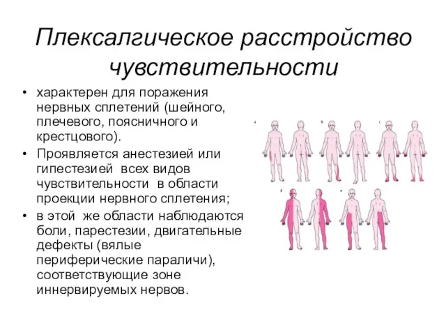 Плексалгическое расстройство чувствительности характерен для поражения нервных сплетений (шейного, плечевого, поясничного и