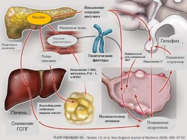 Инсулин Инсулино-резистентность Гипер-гликемия Повышение секреции инсулина Генетические факторы Поджелудоч-ная железа Печень Снижение