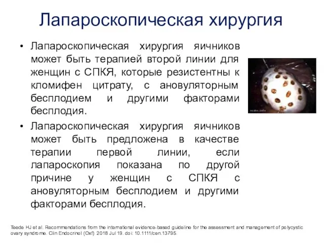 Лапароскопическая хирургия Лапароскопическая хирургия яичников может быть терапией второй линии для женщин